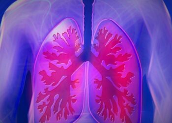 Tumore al polmone: riduzione del rischio di morte del 28% con immunoterapia
