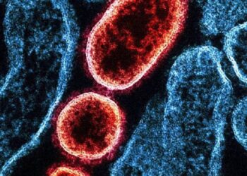 Virus Nipah: una malattia infettiva pericolosa in India