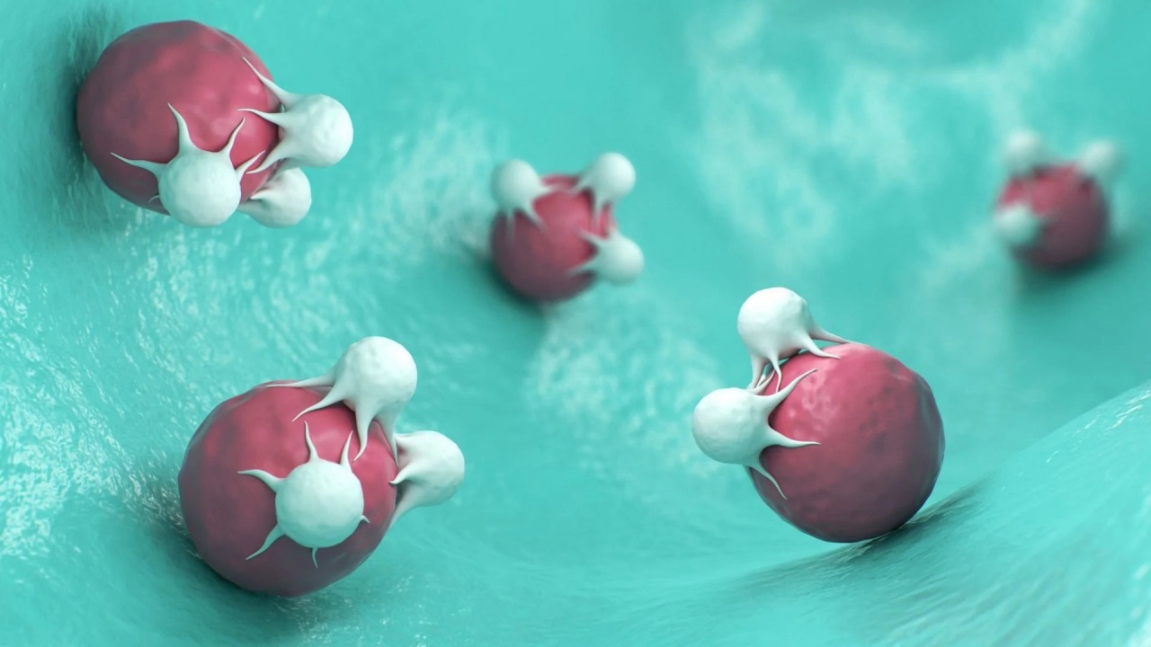 Mieloma multiplo: un inibitore di ferro apre la strada a trattamenti più efficaci