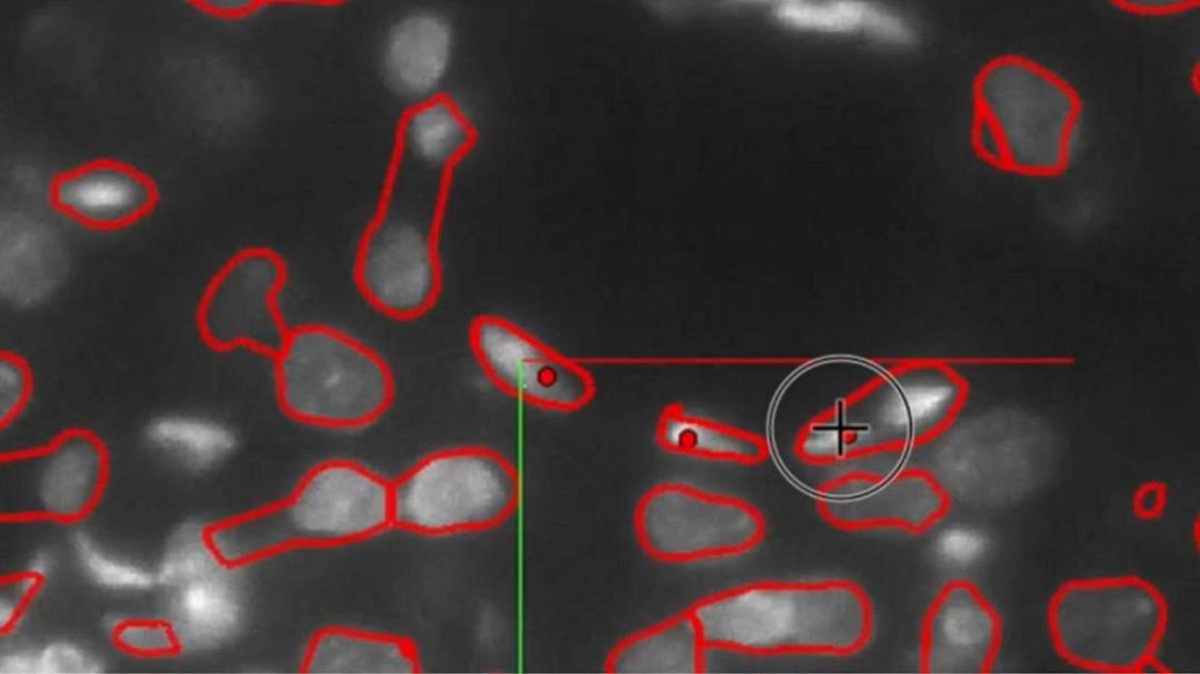 I ricercatori hanno sviluppato un atlante cerebrale basato su IA per comprendere meglio l’Alzheimer