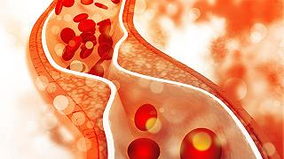 I ricercatori hanno scoperto in che modo il colesterolo influenza l’organizzazione delle membrane cellulari