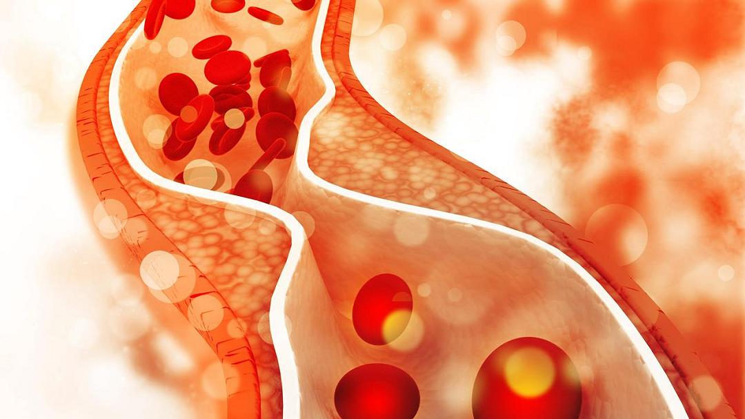 I ricercatori hanno scoperto in che modo il colesterolo influenza l’organizzazione delle membrane cellulari