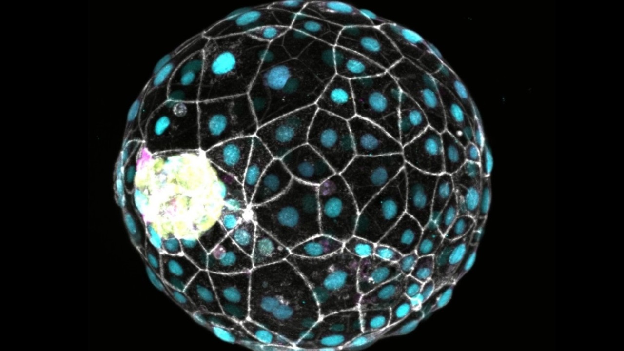 Scoperta molecola misteriosa nei geni umani: cosa significa per la salute