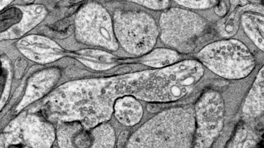 Rivelata la vera struttura dei neuroni che mette in discussione le teorie precedenti