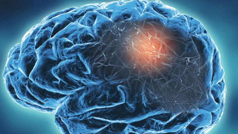 declino della funzione cerebrale con l'età