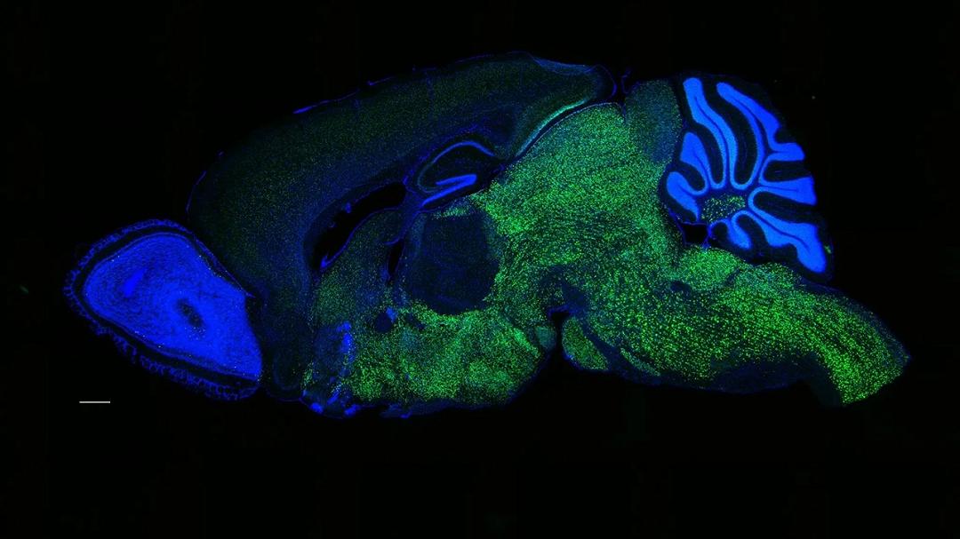 Ricerche recenti svelano il ruolo delle mutazioni genetiche nell’evoluzione del linguaggio