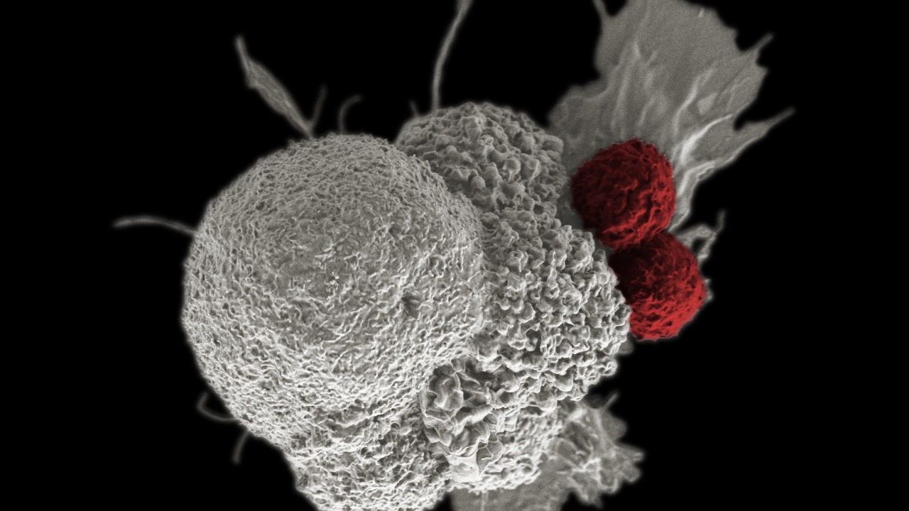 Cellule viventi programmate: una speranza per contrastare il cancro