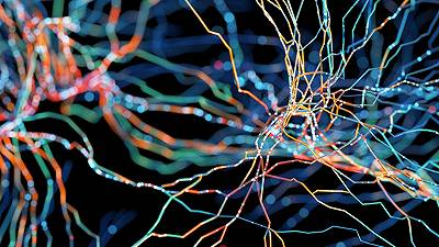 ADHD e demenza: un misterioso collegamento svelato dal ferro cerebrale
