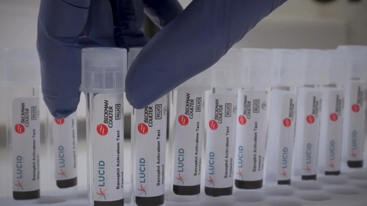 Nuovi orizzonti nella ricerca: arriva un test innovativo per le allergie