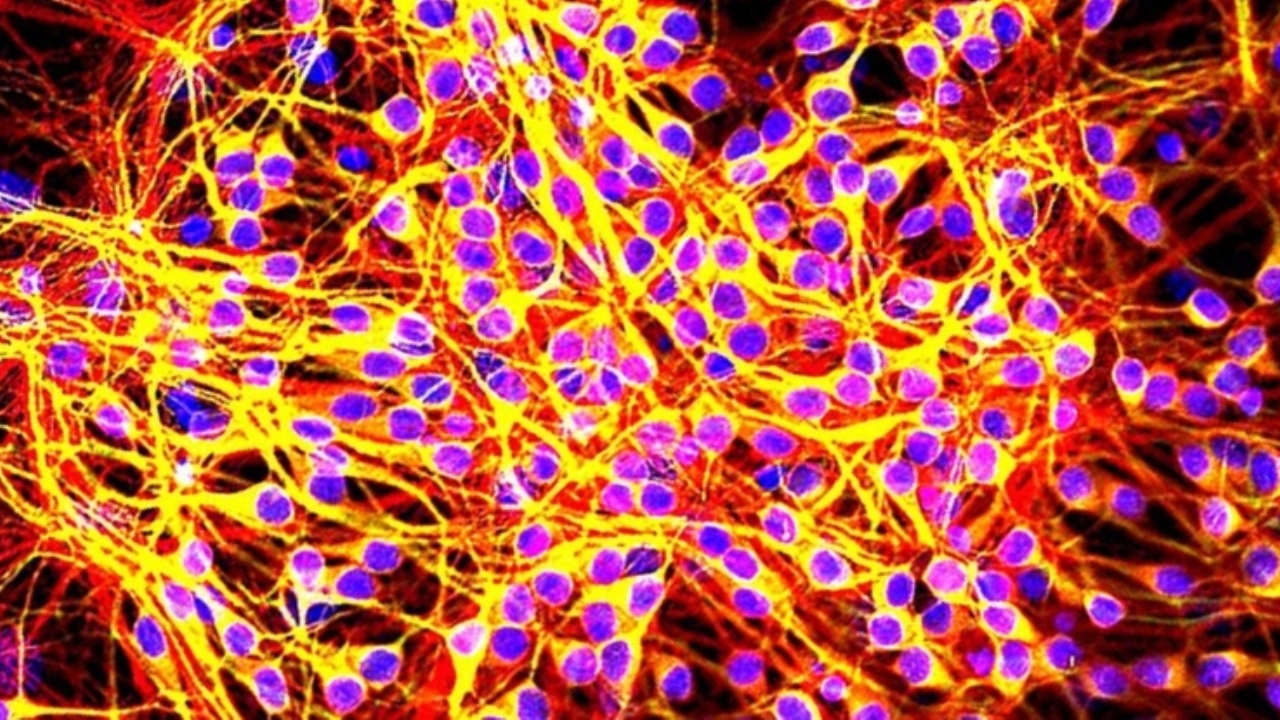 Studio preclinico rivela un potenziale alleato contro la demenza