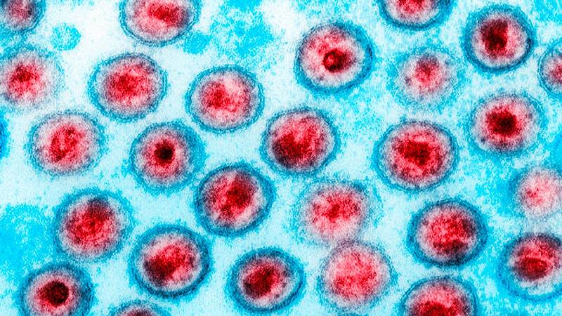 micrografia elettronica a trasmissione dell'HIV-1
