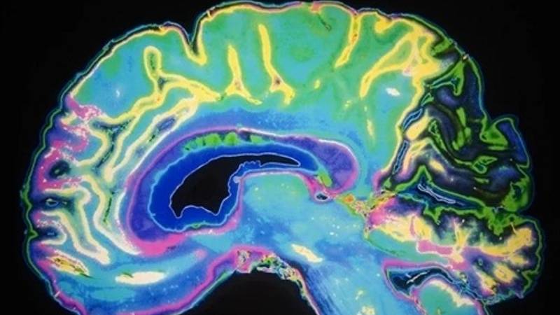 tecnologia delle interfacce cervello-computer