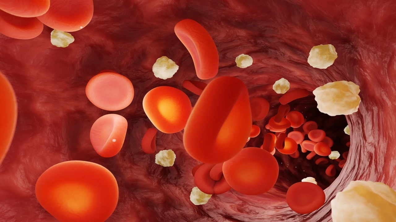 Un nuovo test da 200 dollari rivoluziona la prevenzione cardiovascolare nei pazienti diabetici