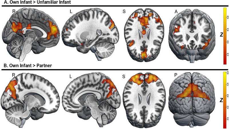 i genitori hanno mostrato una maggiore attività cerebrale quando osservavano il proprio bambino