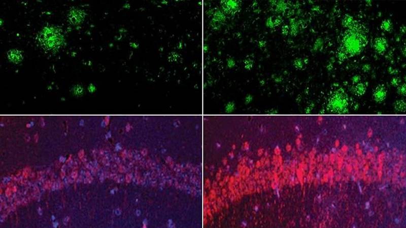 il ruolo del litio nella malattia di Alzheimer