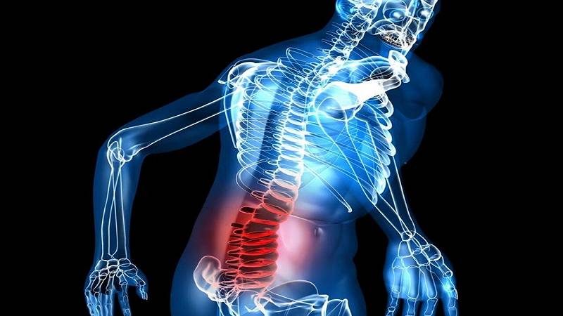 un approccio psicologico cura il mal di schiena