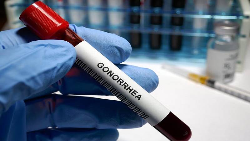 uno dei nuovi farmaci, chiamato NG1, è stato progettato per colpire specificamente la gonorrea