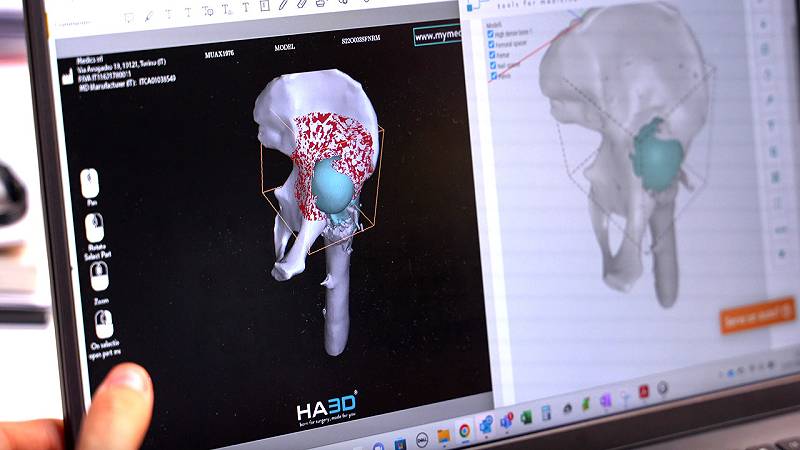 materiale stampato in 3D per la formazione medica
