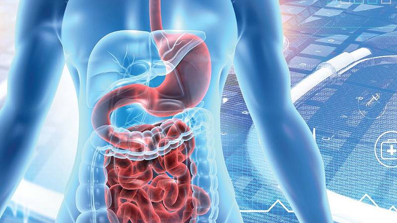cancro al colon