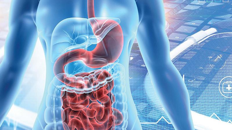 cancro al colon