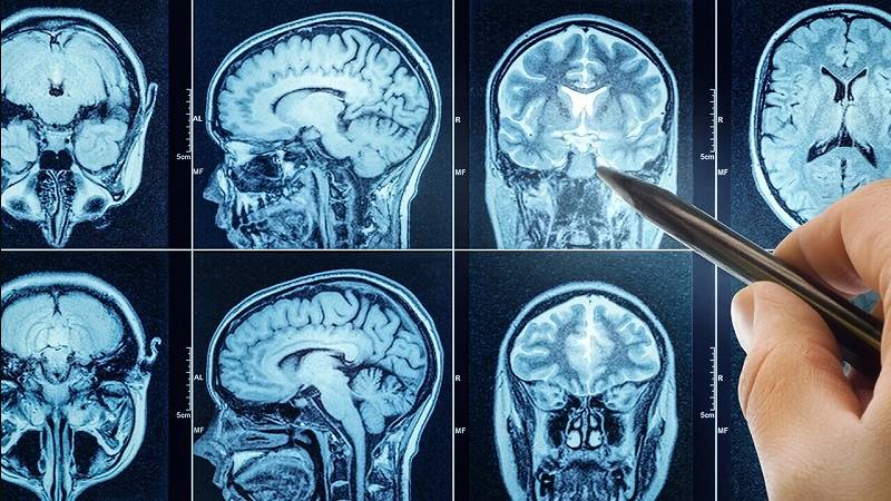 dormire male accelera l'invecchiamento del cervello