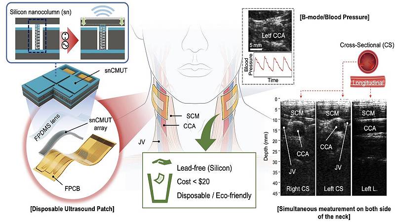 ecografia e misurazione simultanea della pressione sanguigna di entrambe le arterie carotidi utilizzando un cerotto ecografico monouso ecologico