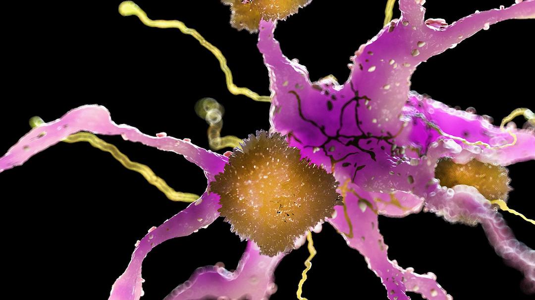 Alzheimer, una terapia sperimentale mostra risultati ‘rivoluzionari’ nei topi