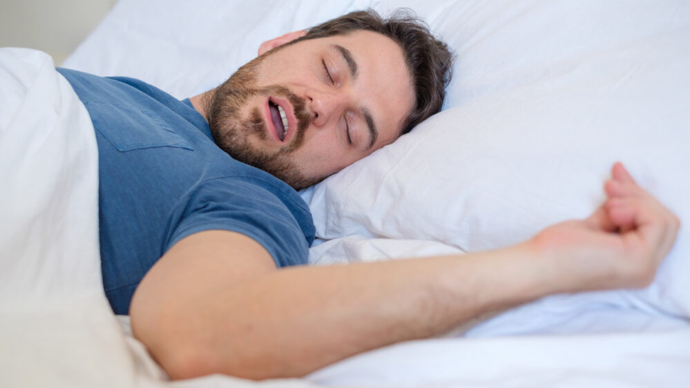 apnea notturna ostruttiva