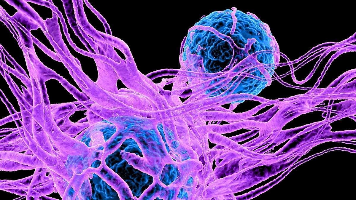 Indagato un possibile legame tra serotonina e cellule tumorali