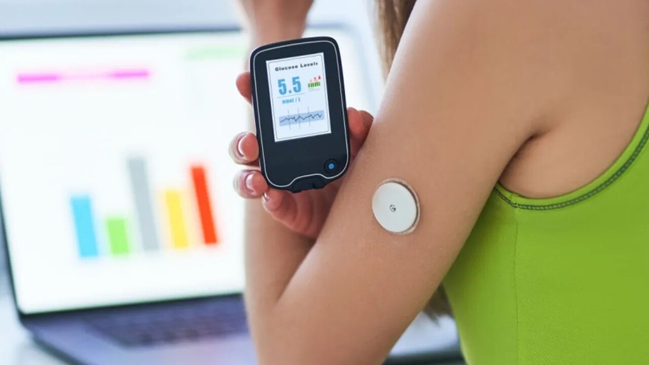 monitoraggio continuo del glucosio nel diabete di tipo 2