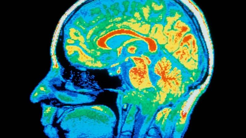 studio su 14 disturbi psichiatrici