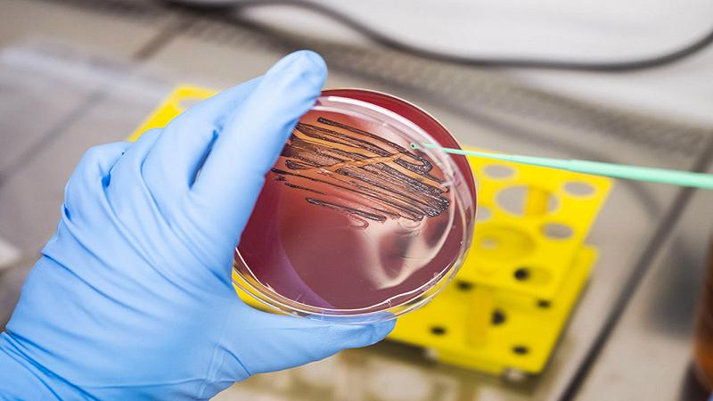 coltura del batterio Porphyromonas gingivalis, uno dei principali agenti patogeni della parodontite