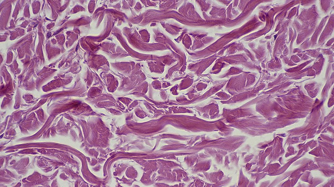 Nuove frontiere dell’età: trovati i fattori che spingono le cellule a ringiovanire