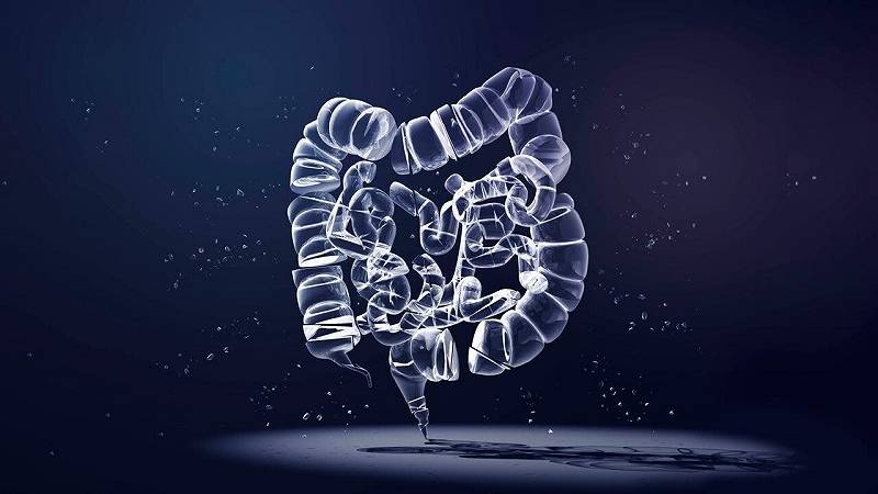 cancro del colon-retto