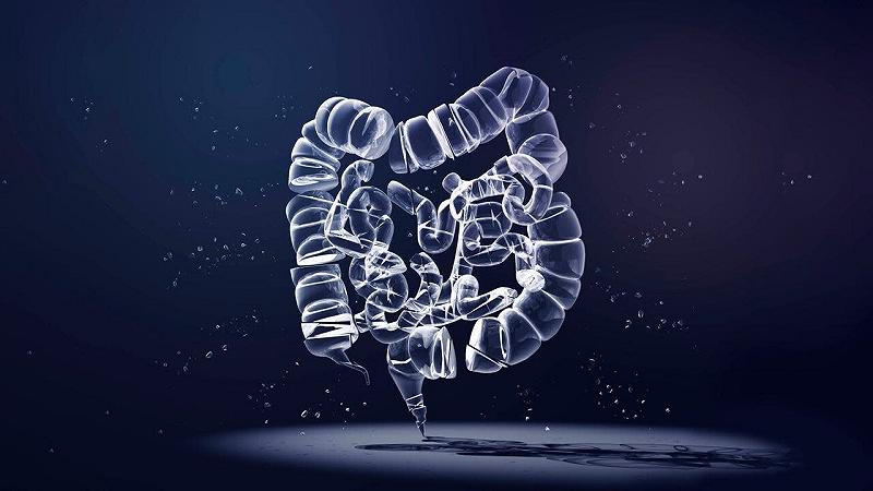 cancro del colon-retto