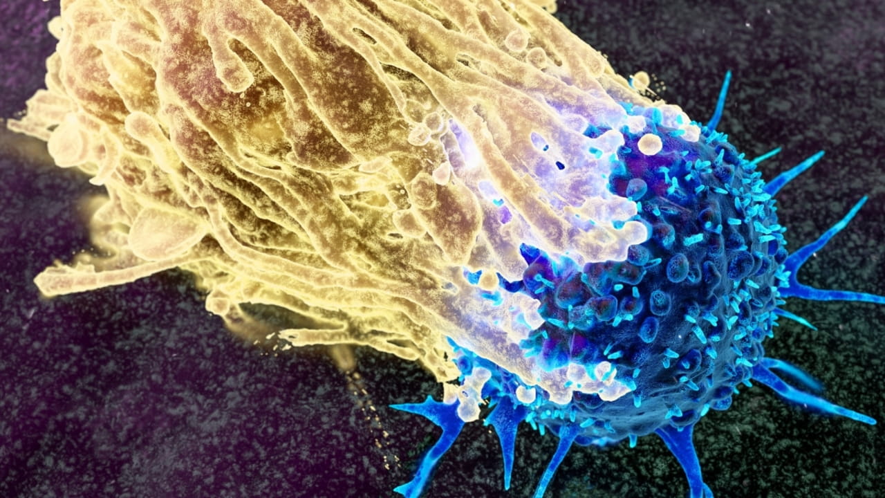 illustrazione di una cellula macrofaga umana che attacca una cellula cancerosa