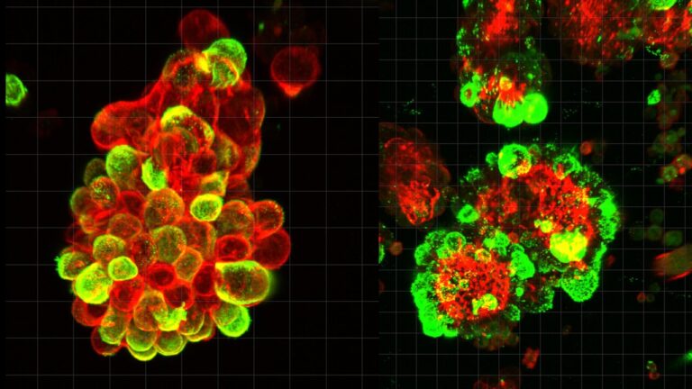 La scienza chiarisce un mistero: perché alcuni tumori si espandono così velocemente
