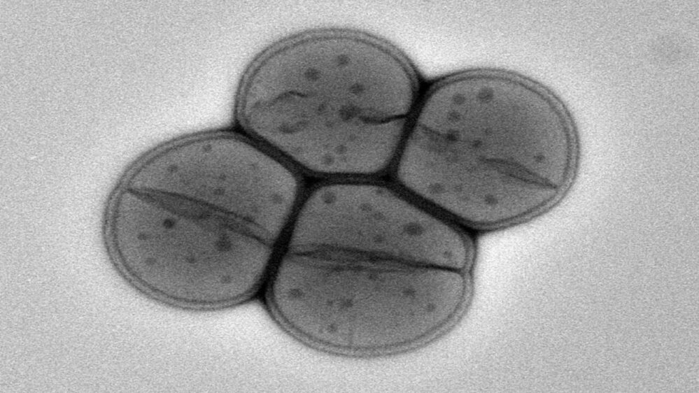batterio Deinococcus radiodurans